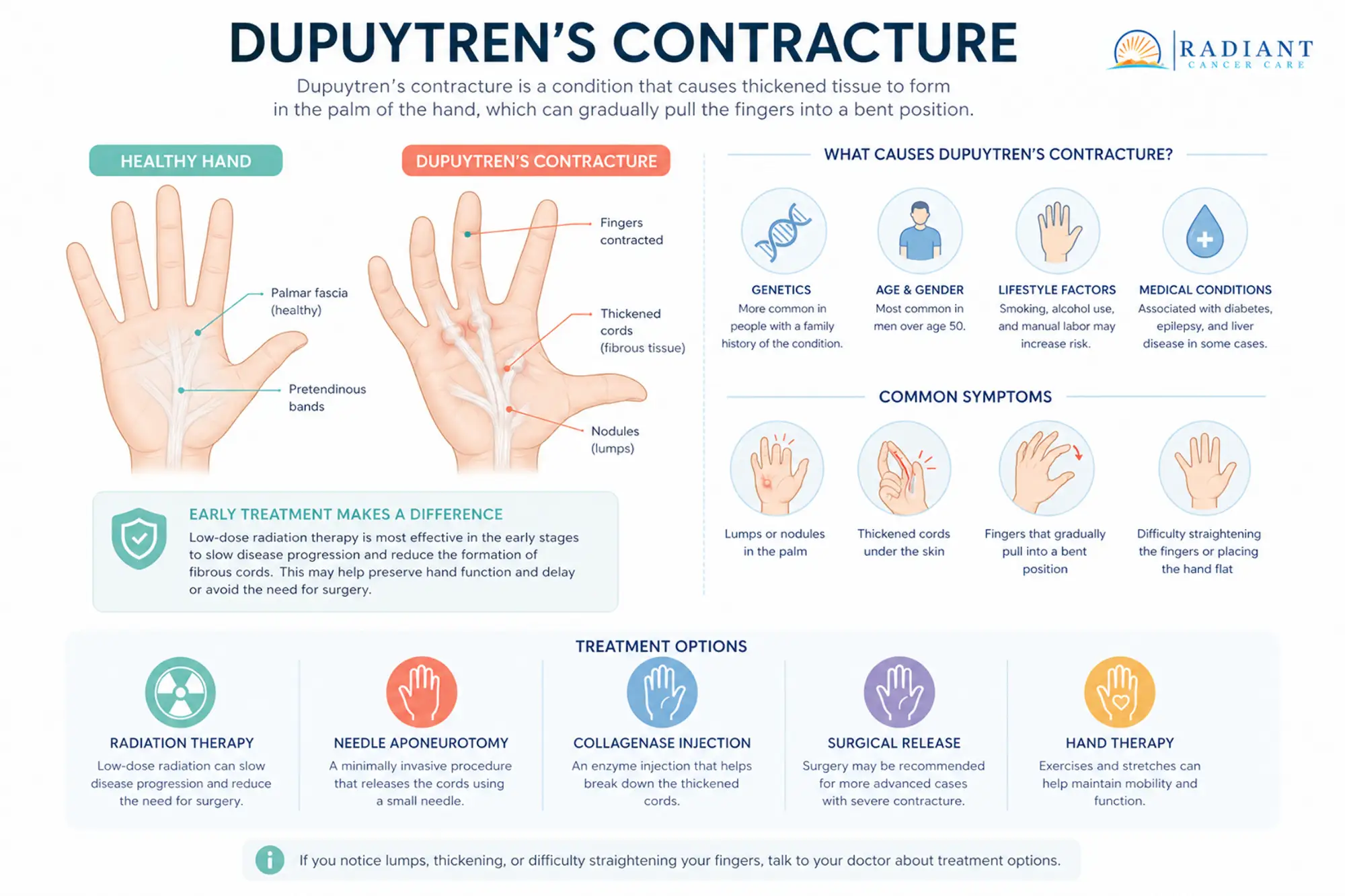 Dupuytren’s Contracture.compressed Dupuytren’s Contracture.compressed