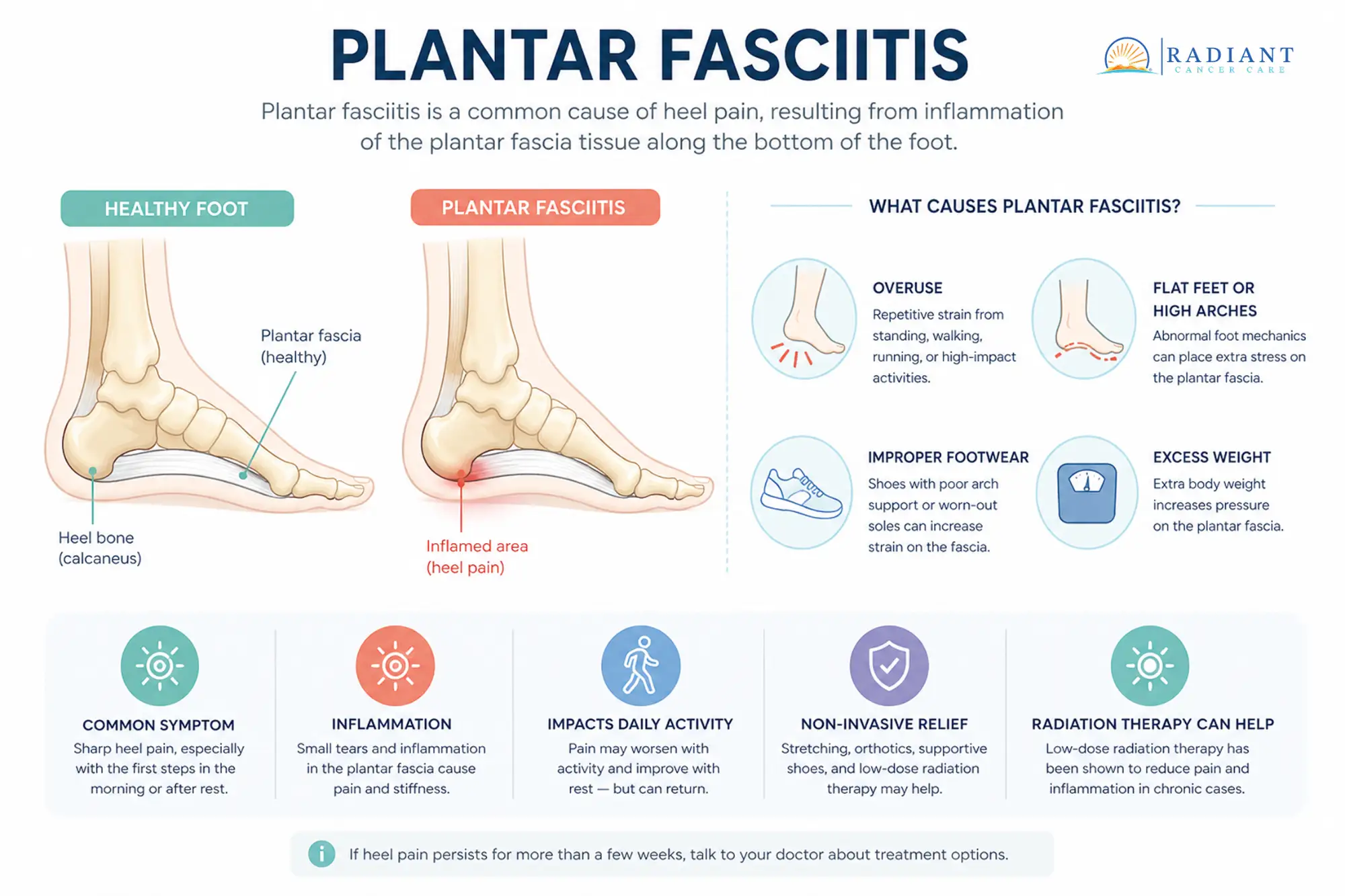 Plantar Fasciitis.compressed Plantar Fasciitis.compressed