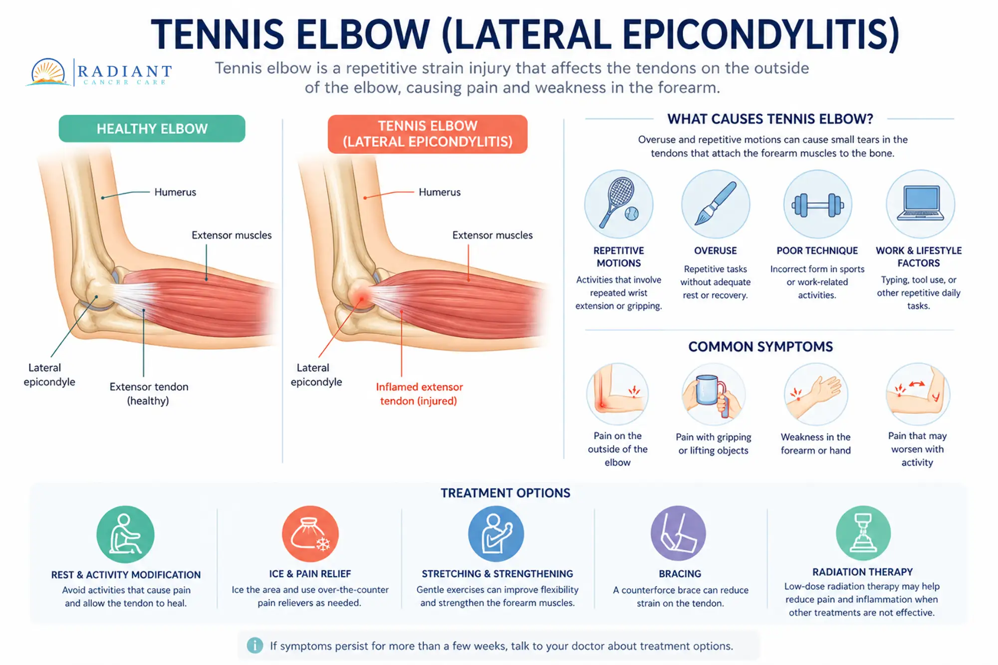 Tennis Elbow (Epicondylitis).compressed