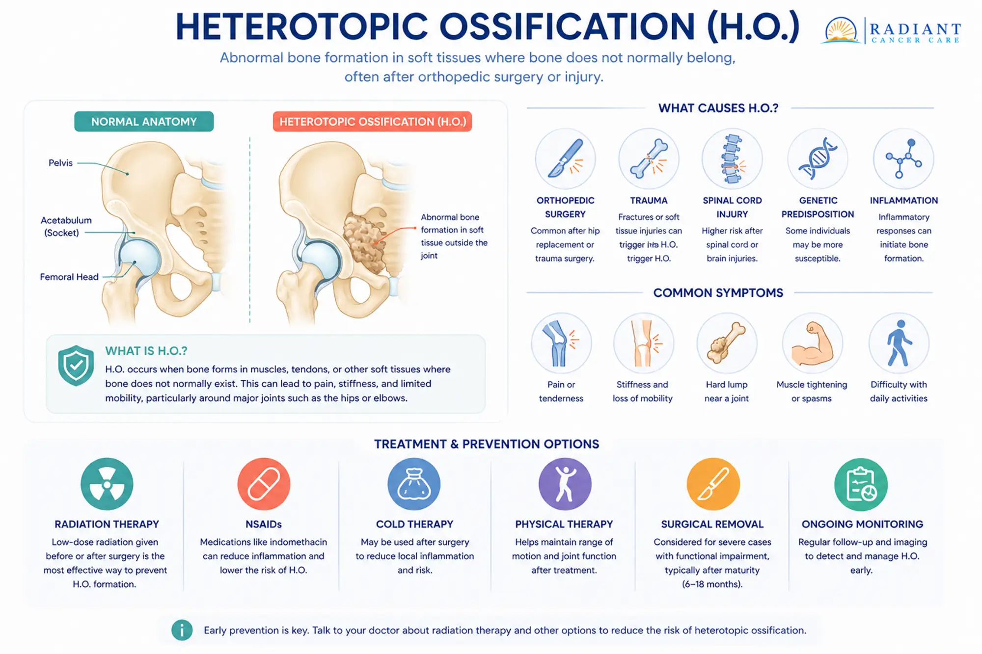Heterotopic Ossification (H.O.).compressed Heterotopic Ossification (H.O.).compressed